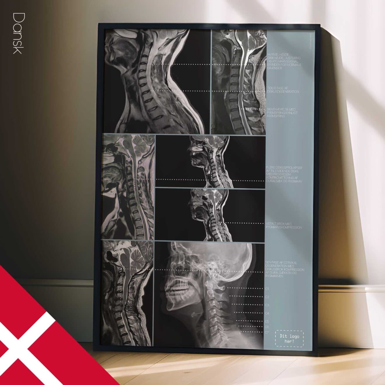 Kunstwerk zur Zervikalpathologie von educare.design