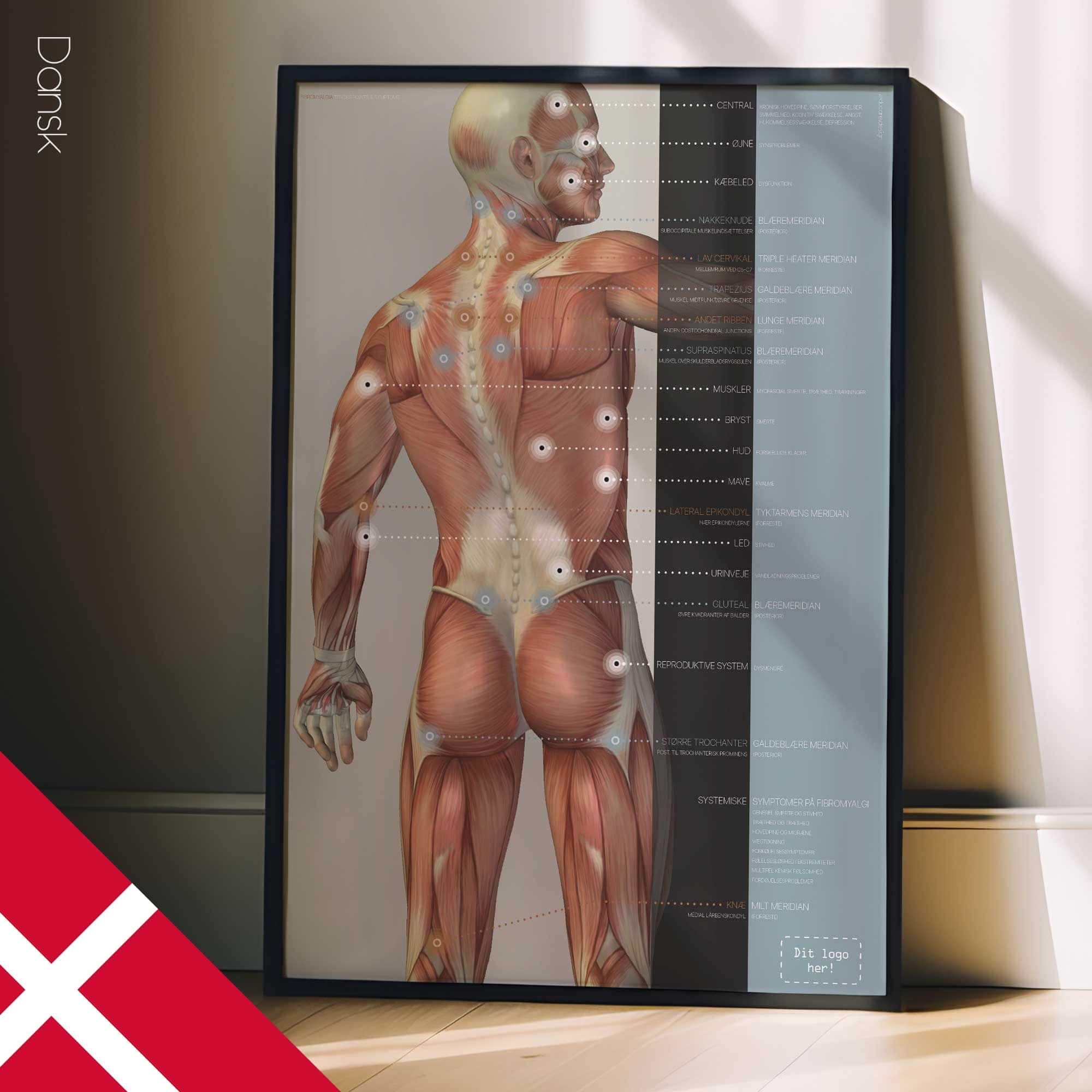 Fibromyalgia; Tender Points & Symptoms. Anatomy and physiology artwork from educare.design