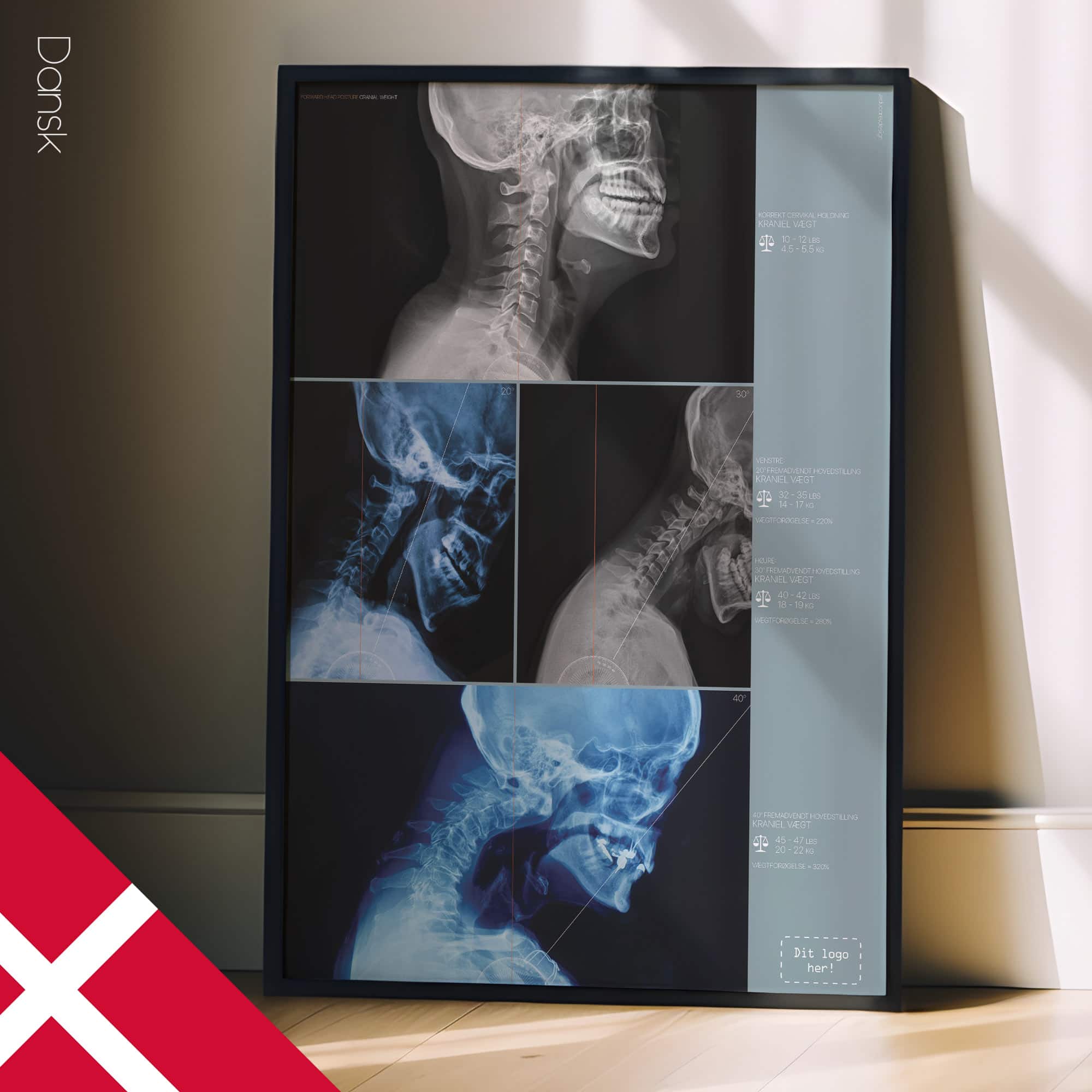 Postura della testa in avanti