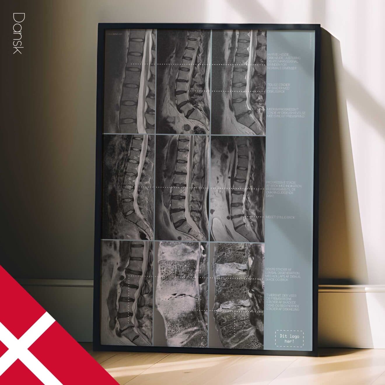 Opere d'arte sulla patologia lombare da educare.design