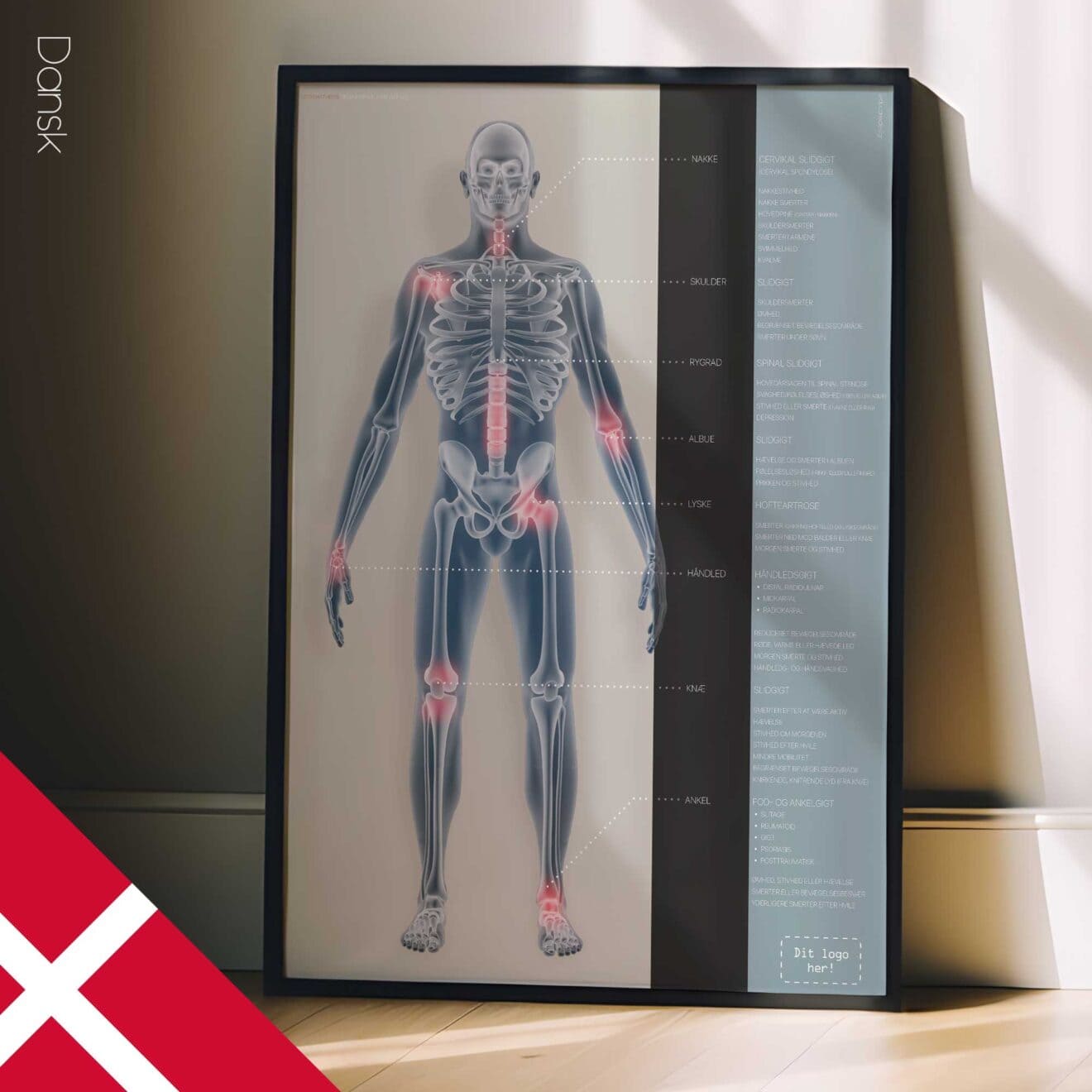 Arthrose. Dessin d'anatomie et de physiologie d'educare.design