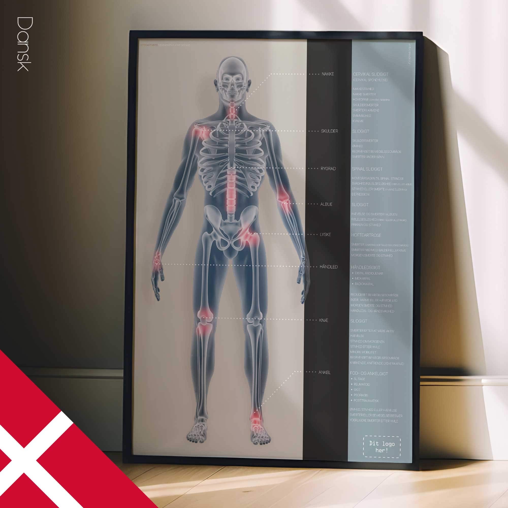 Osteoartrite. Opere d'arte di anatomia e fisiologia da educare.design