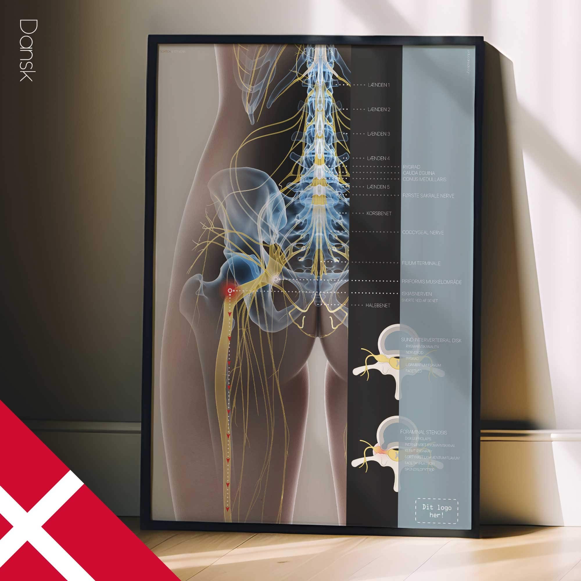 Sciatica and stenosis artwork from educare.design