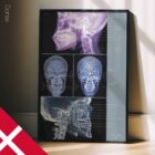 Disturbo dell'ATM. Opere d'arte di anatomia e fisiologia da educare.design