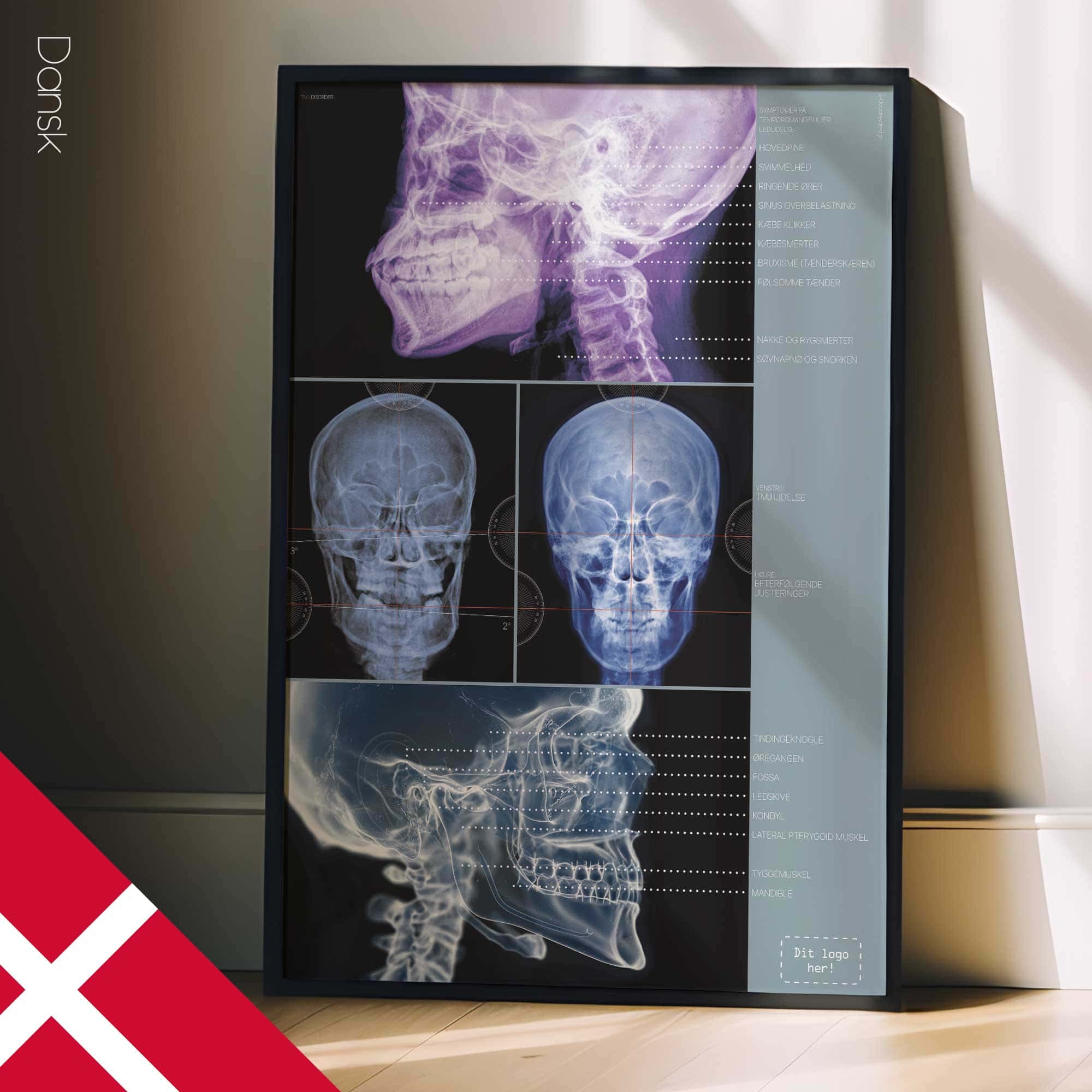 Disturbo dell'ATM. Opere d'arte di anatomia e fisiologia da educare.design