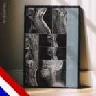 Cervicale Pathologie