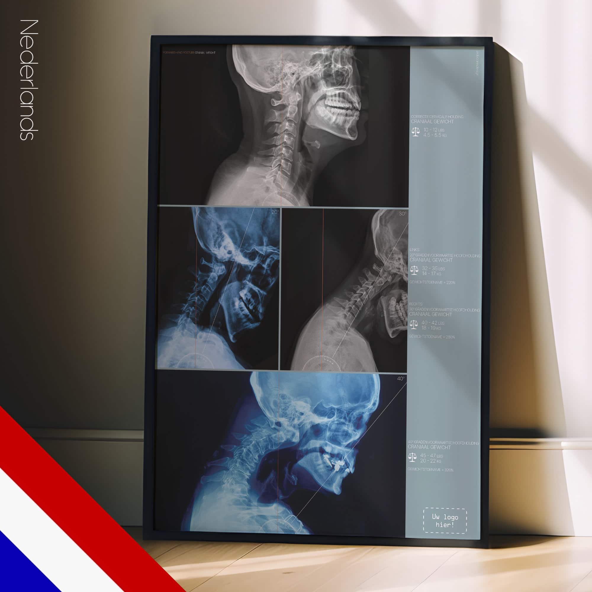 Costruzione di un tetto in legno