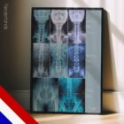 Wervelkolomafwijking