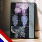 Kaakgewrichtsstoornis