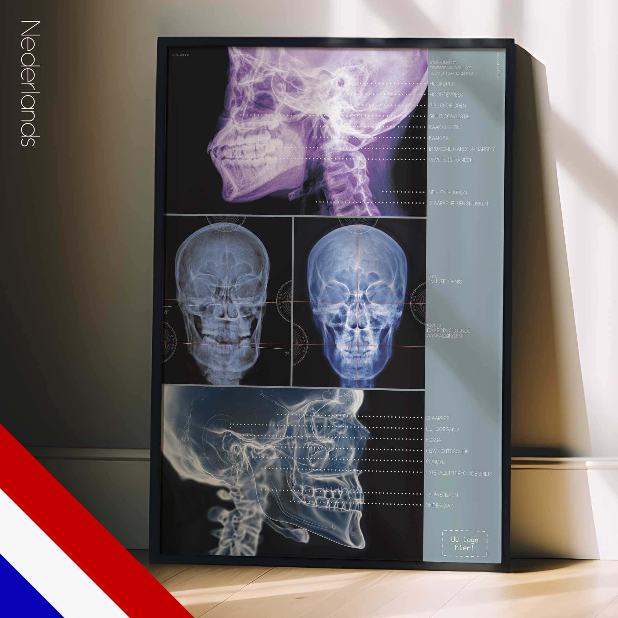 Kaakgewrichtsstoornis