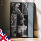 Opere d'arte sulla patologia cervicale da educare.design