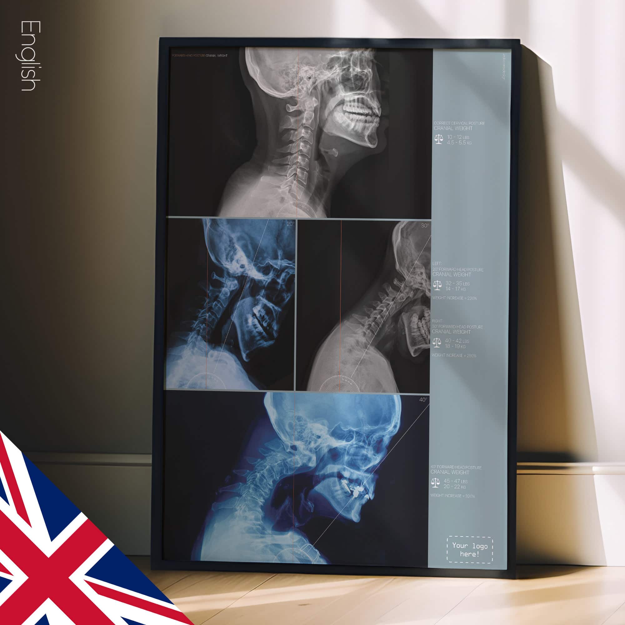 Postura della testa in avanti