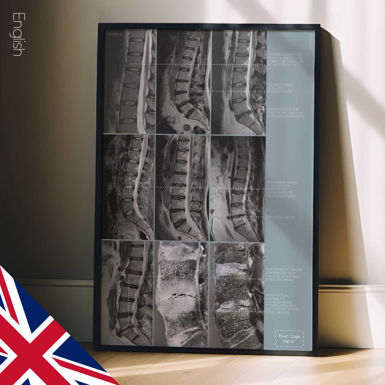 Opere d'arte sulla patologia lombare da educare.design