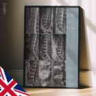 Lumbar Pathology artwork from educare.design