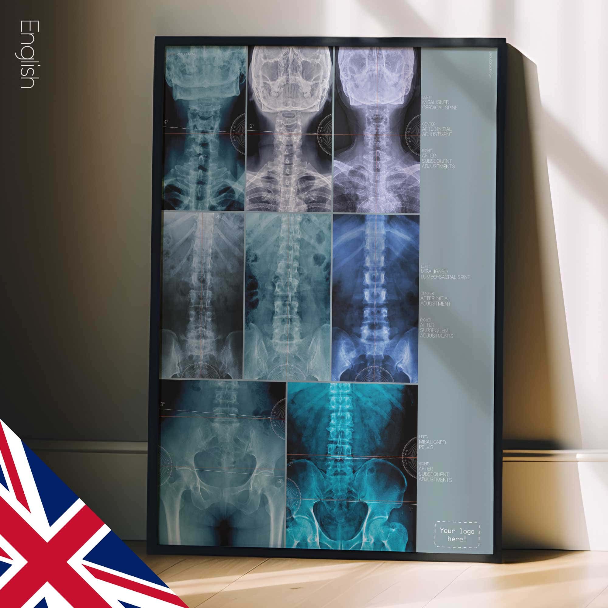 Fehlausrichtung, Anatomie und Physiologie - Kunstwerke von educare.design