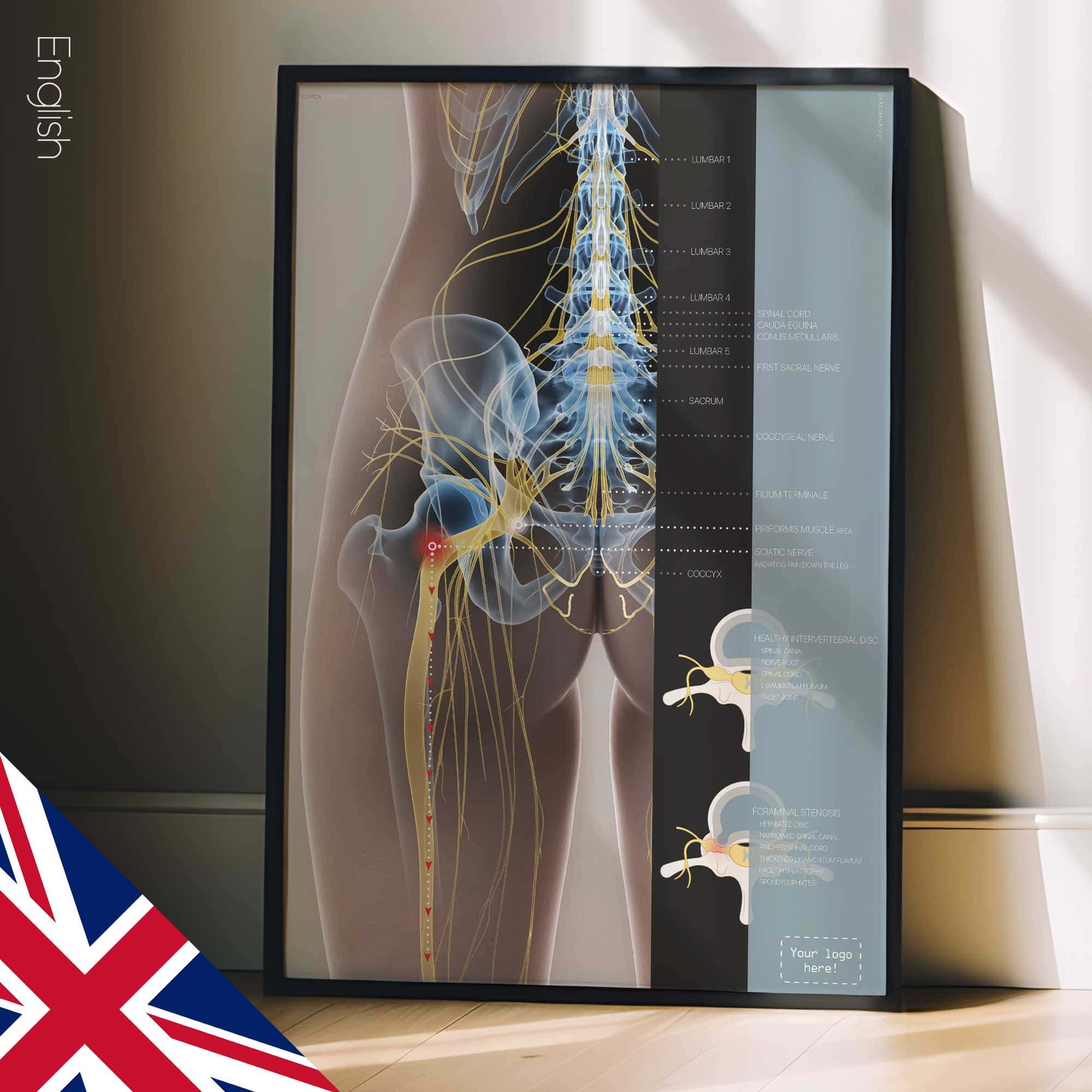 Sciatica and stenosis artwork from educare.design