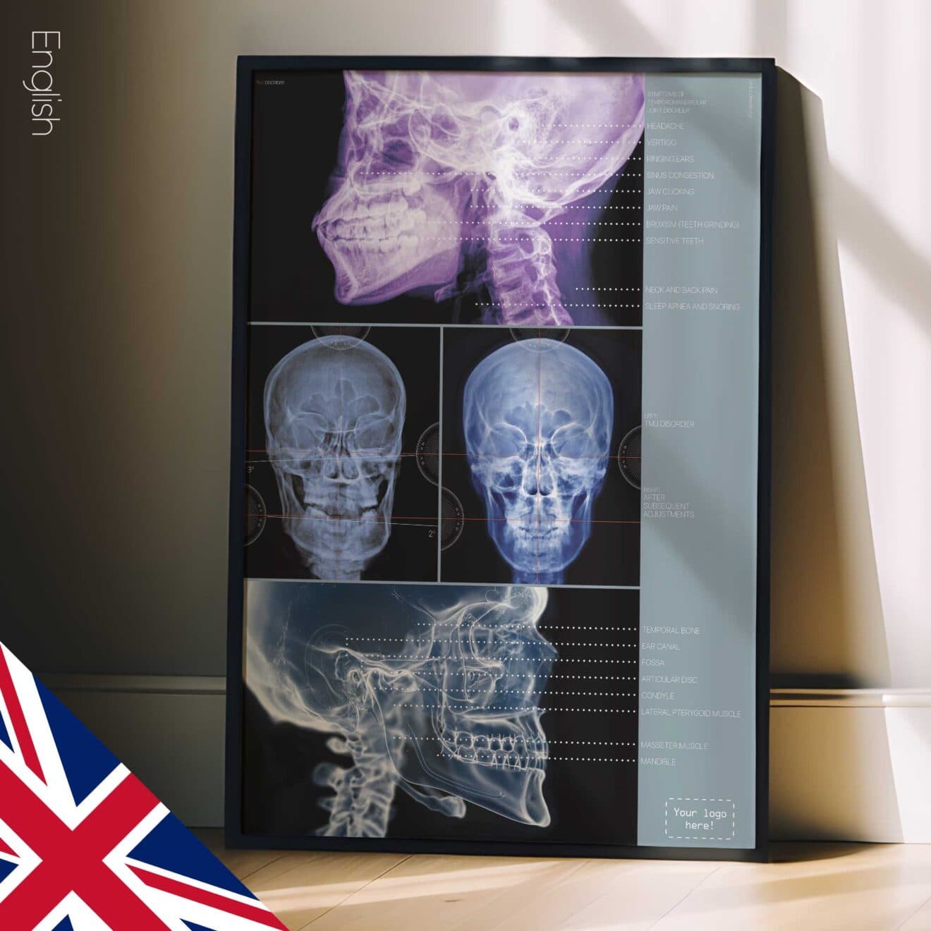 TMJ Disorder. Anatomy and physiology artwork from educare.design