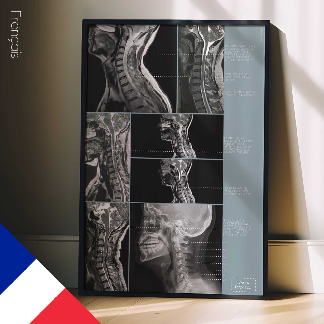 Kunstwerk zur Zervikalpathologie von educare.design