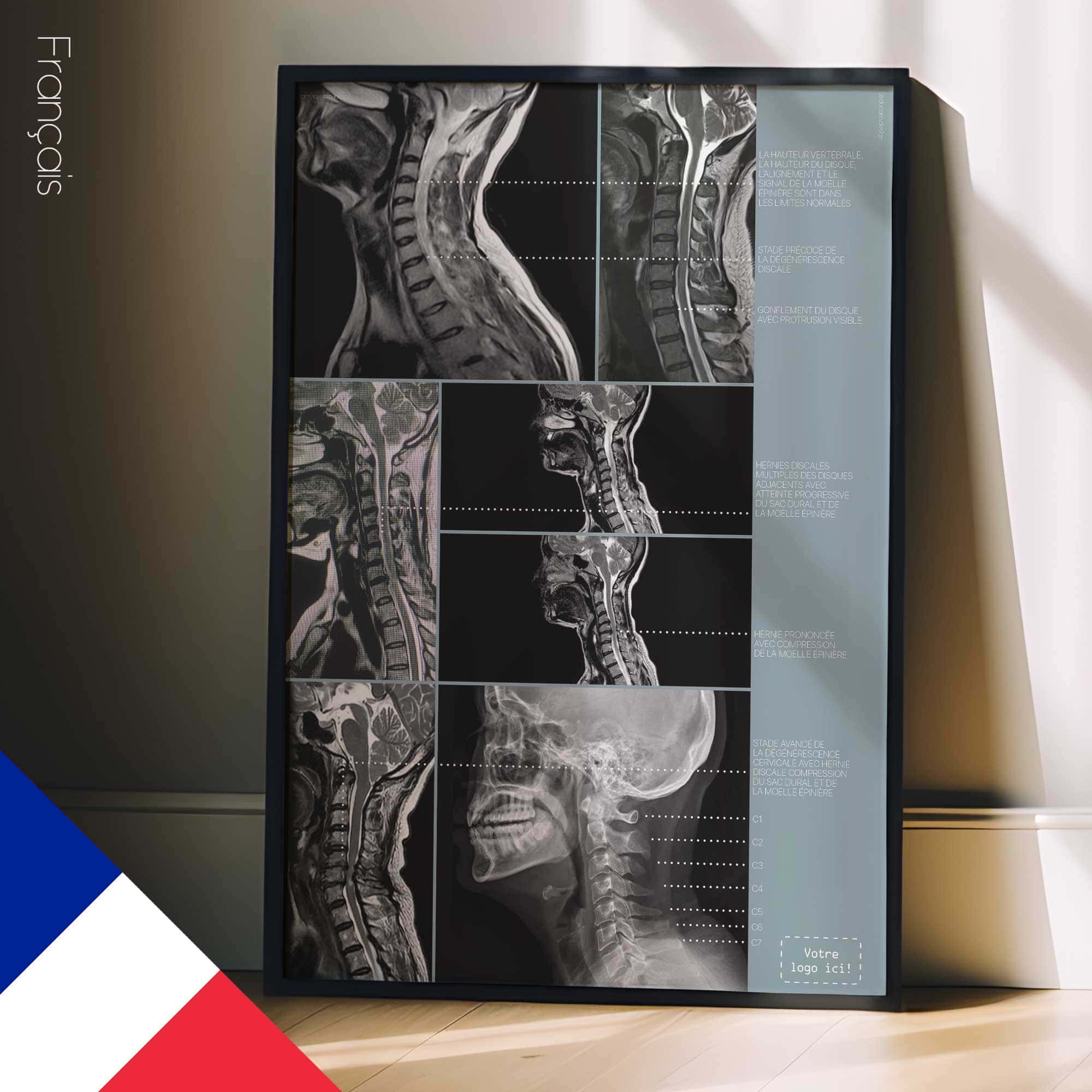 Opere d'arte sulla patologia cervicale da educare.design