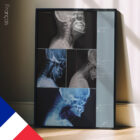 Postura della testa in avanti