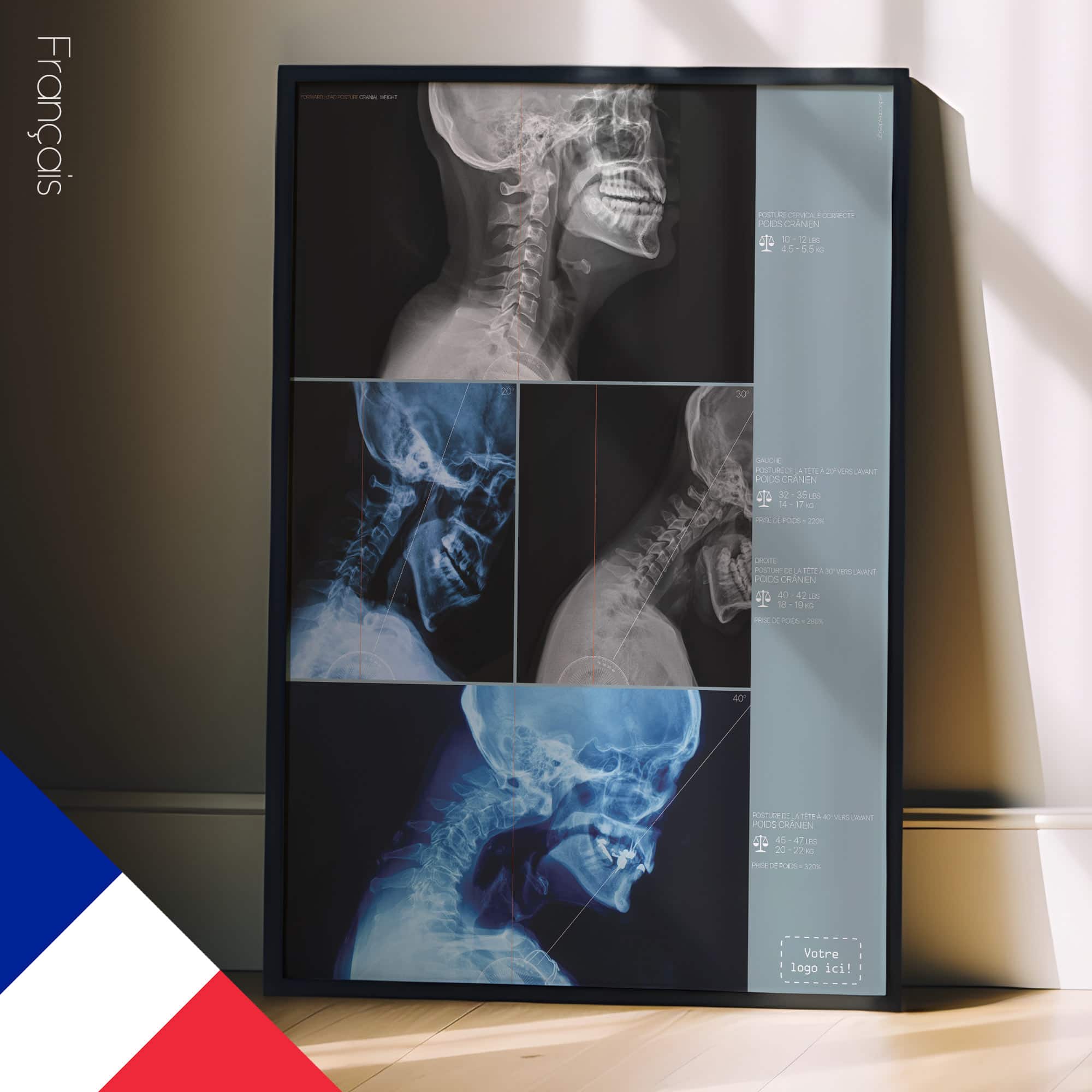 Postura della testa in avanti