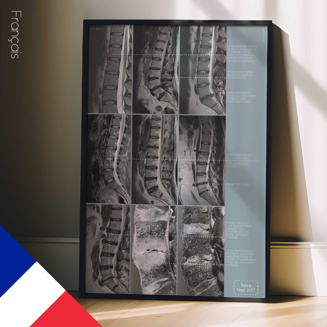 Opere d'arte sulla patologia lombare da educare.design