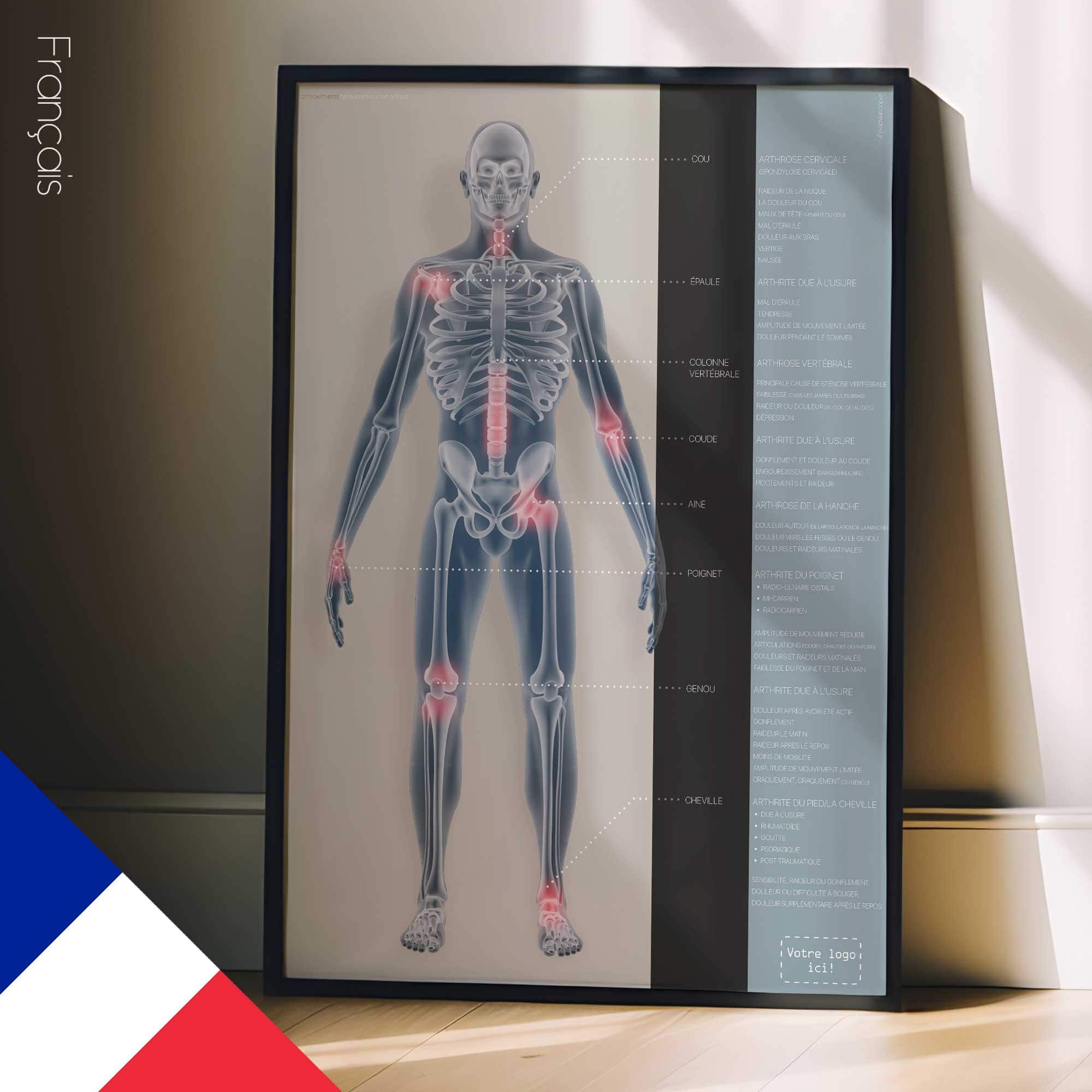 Osteoartrite. Opere d'arte di anatomia e fisiologia da educare.design