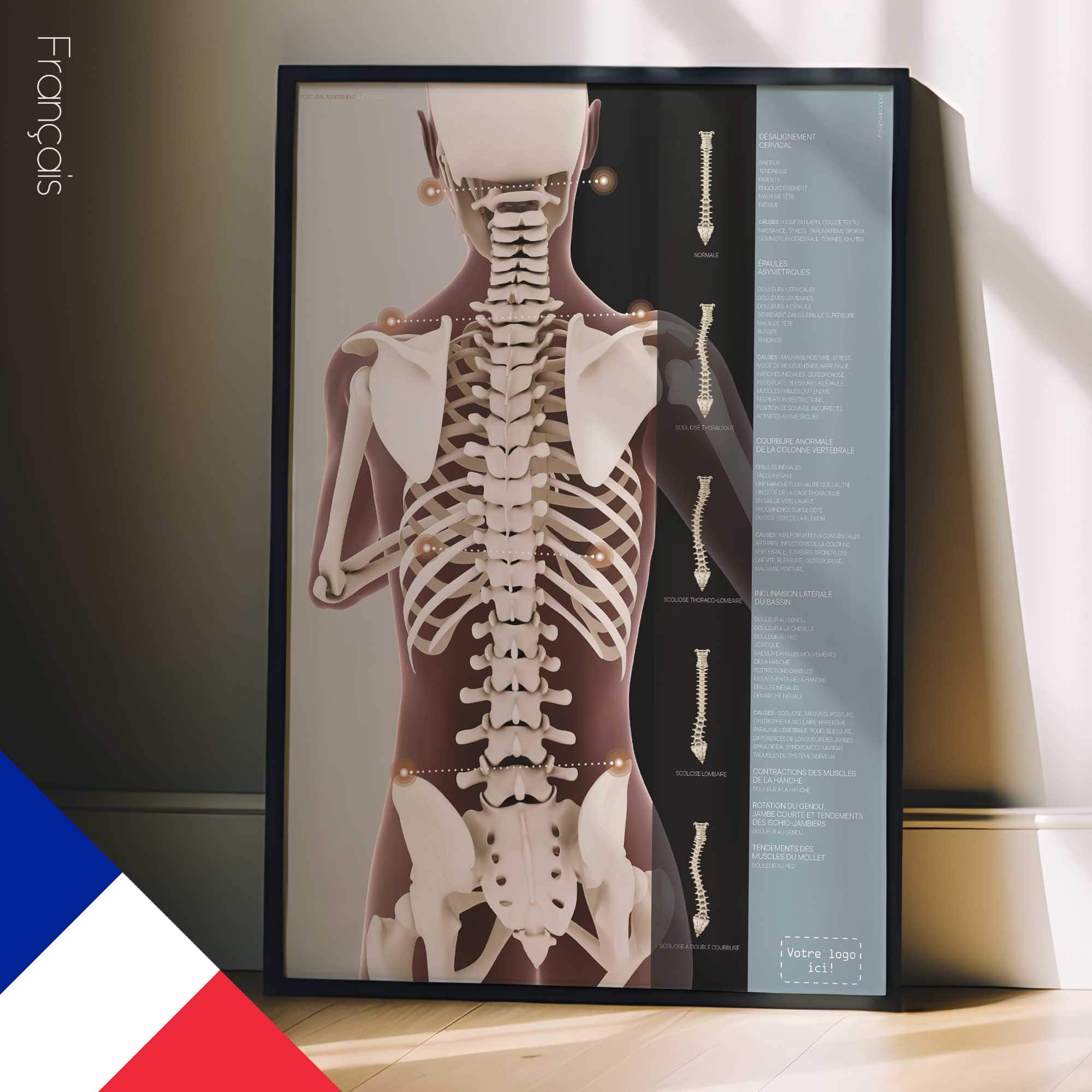 Postural Assessment and Scoliosis. Anatomy and physiology artwork from educare.design