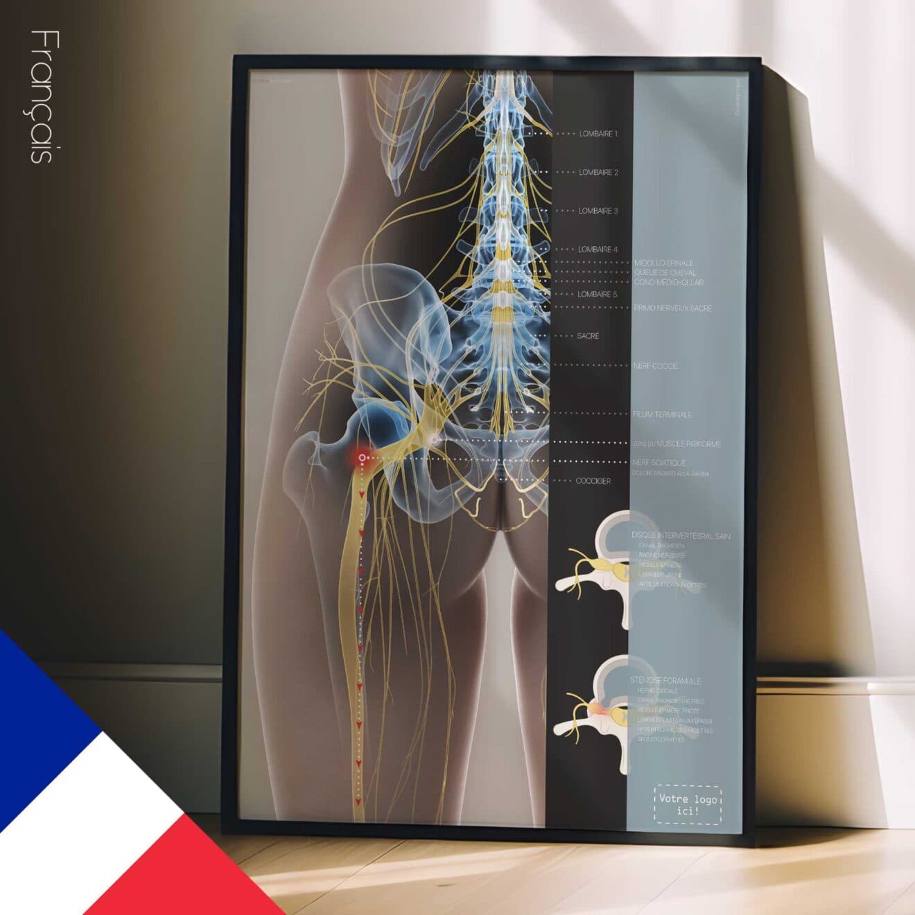 Sciatica and stenosis artwork from educare.design