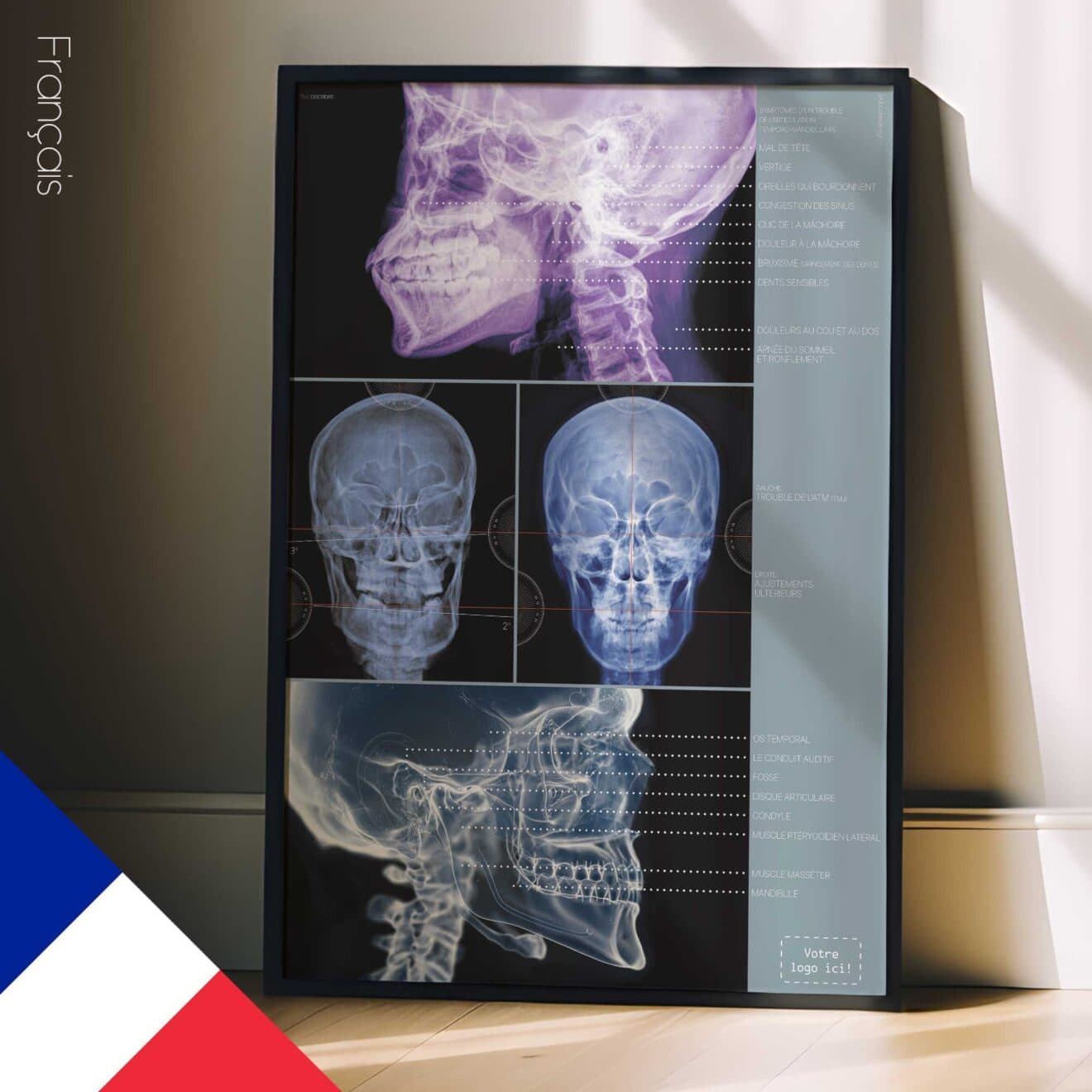 TMJ Disorder. Anatomy and physiology artwork from educare.design