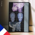 Disturbo dell'ATM. Opere d'arte di anatomia e fisiologia da educare.design