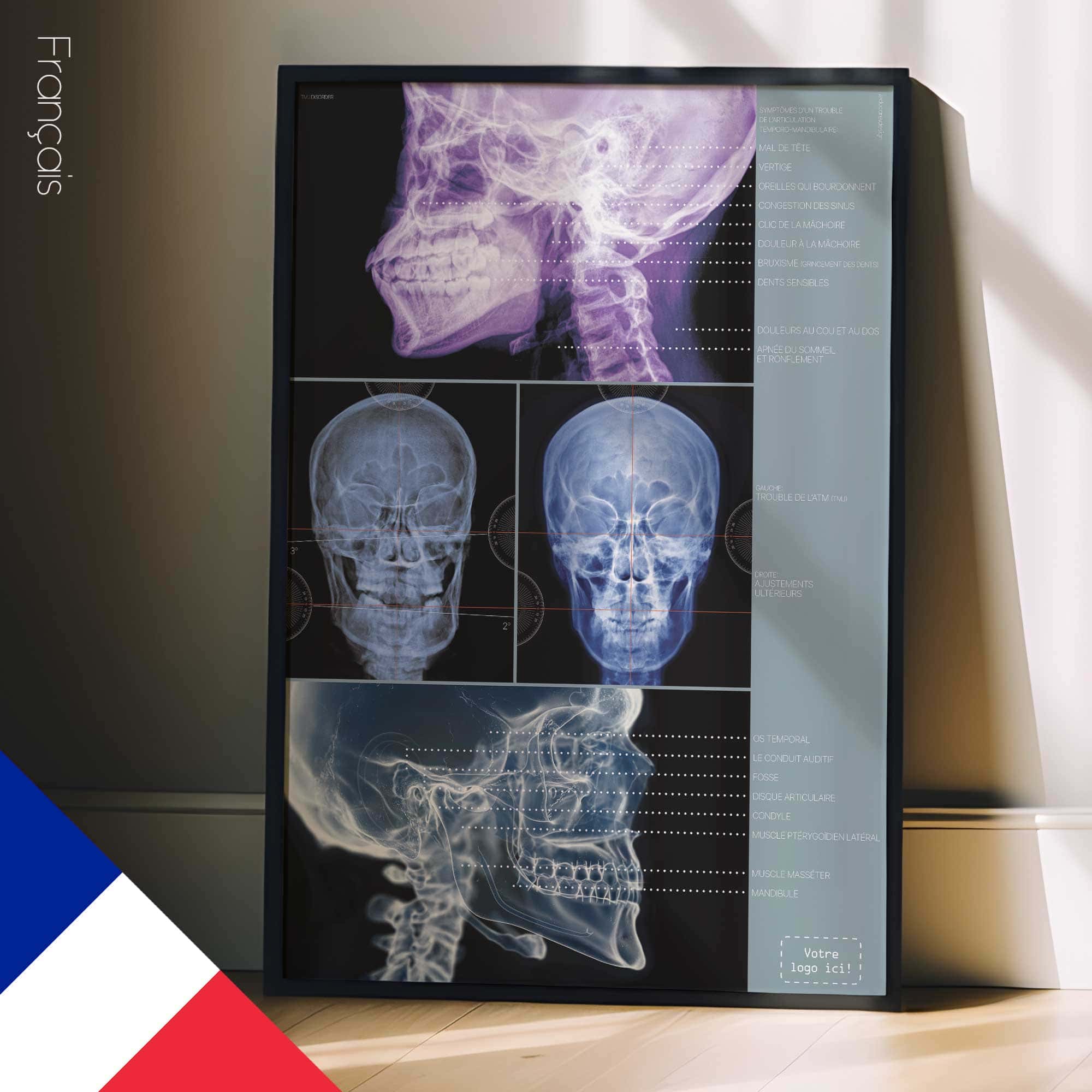 Disturbo dell'ATM. Opere d'arte di anatomia e fisiologia da educare.design