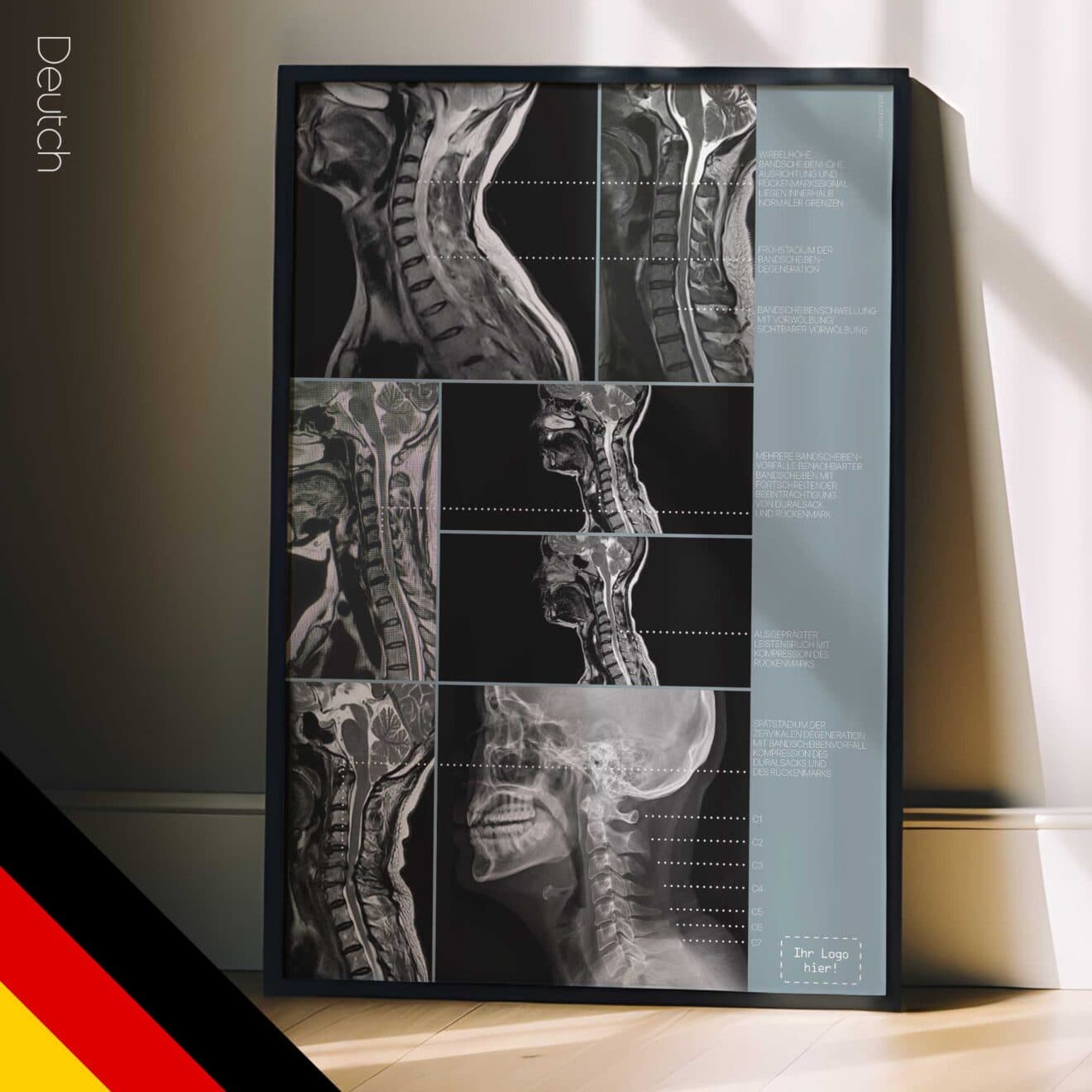 Zervikale Pathologie