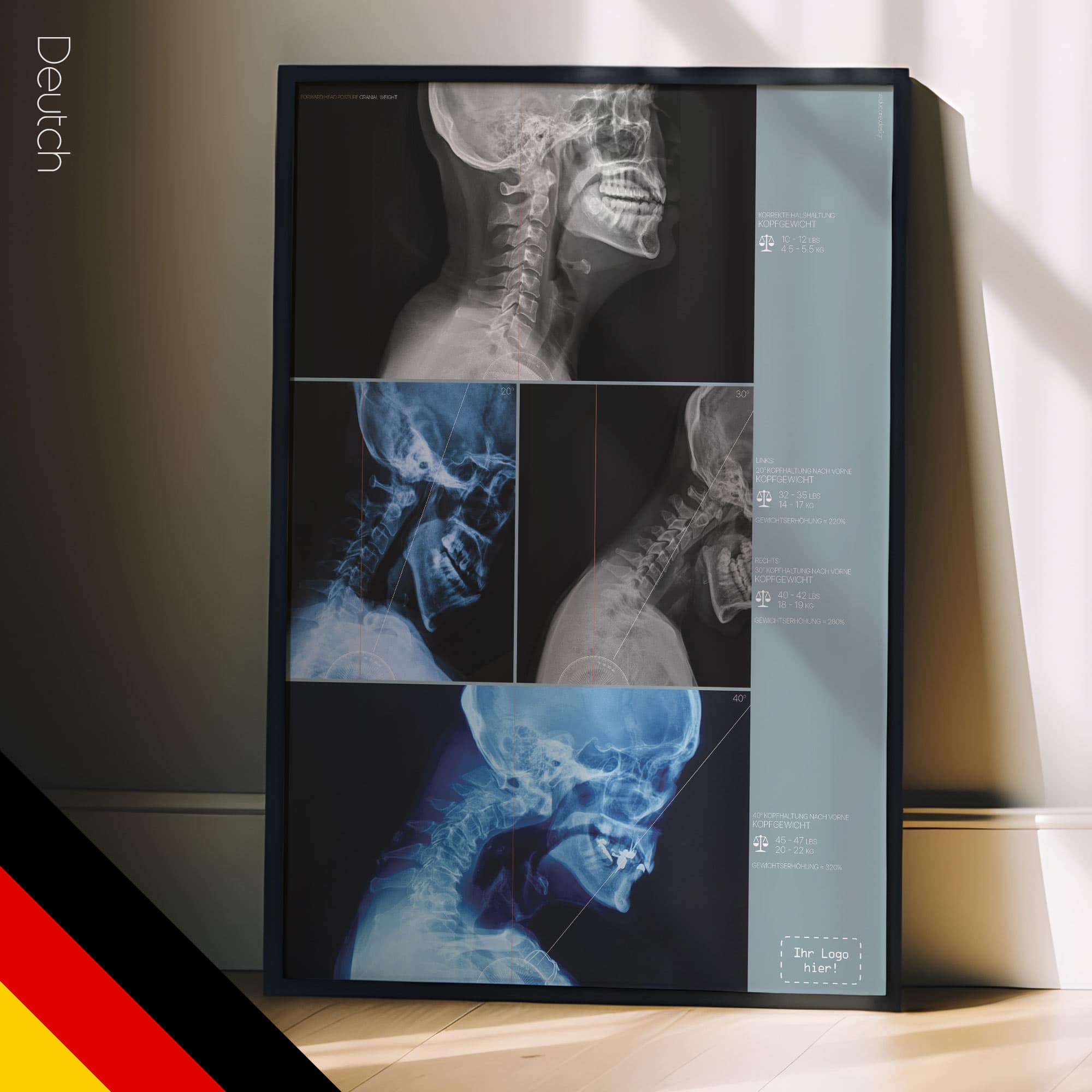 Kopfhaltung nach vorne und Schädelgewicht