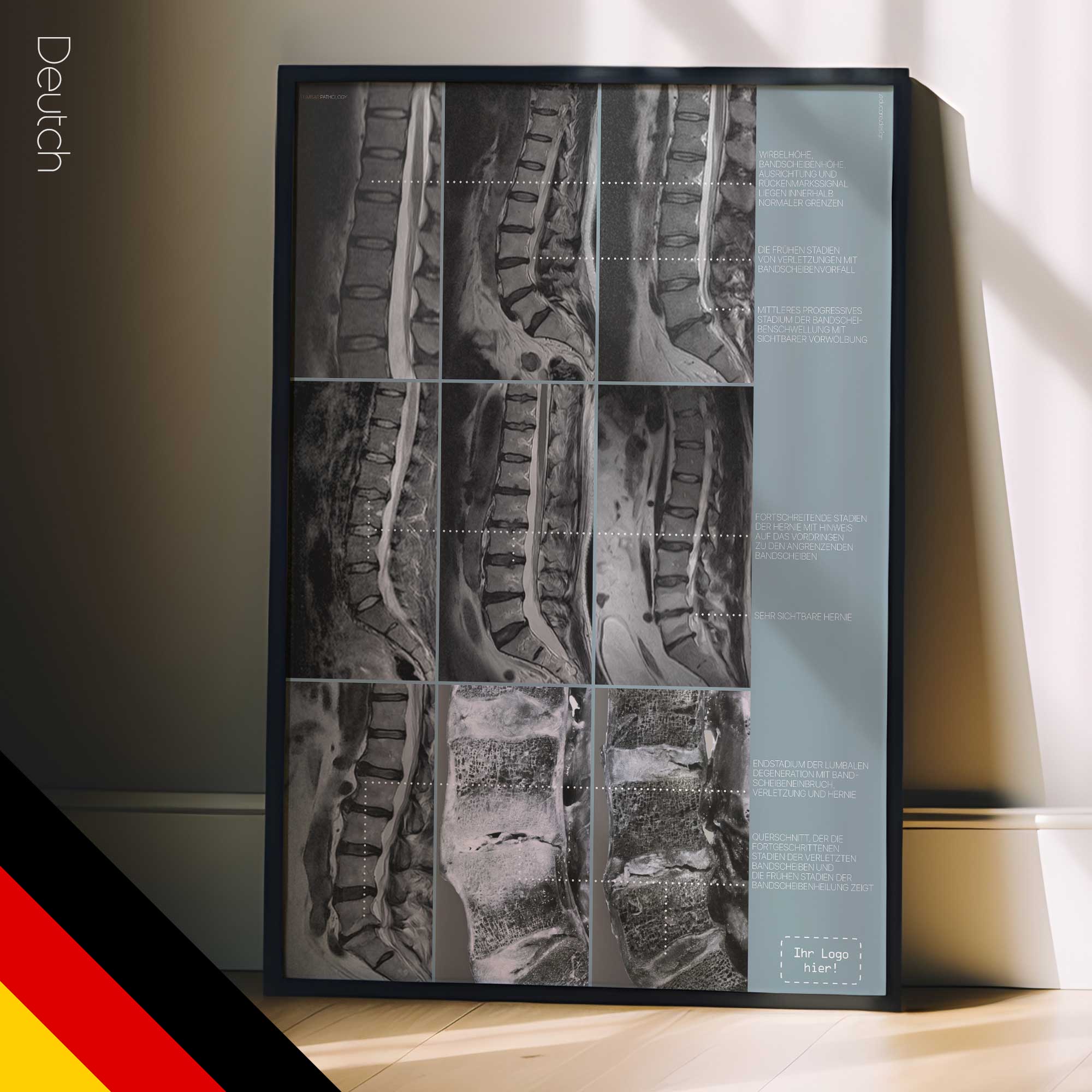 Lumbalpathologie-Kunstwerk von educare.design