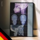 Kiefergelenksstörung