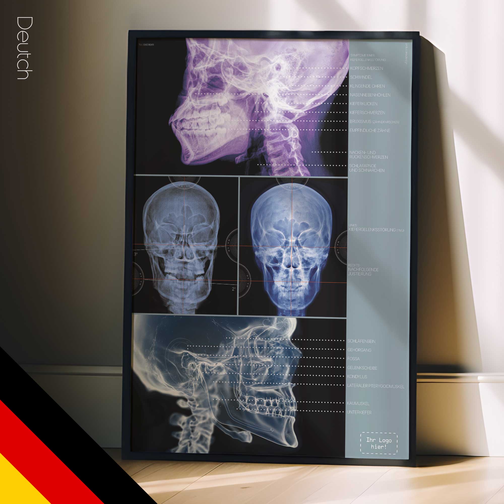 Kiefergelenksstörung