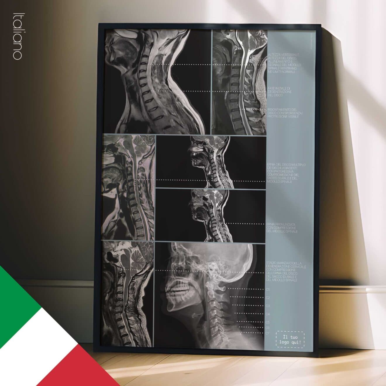 Patologia Cervicale