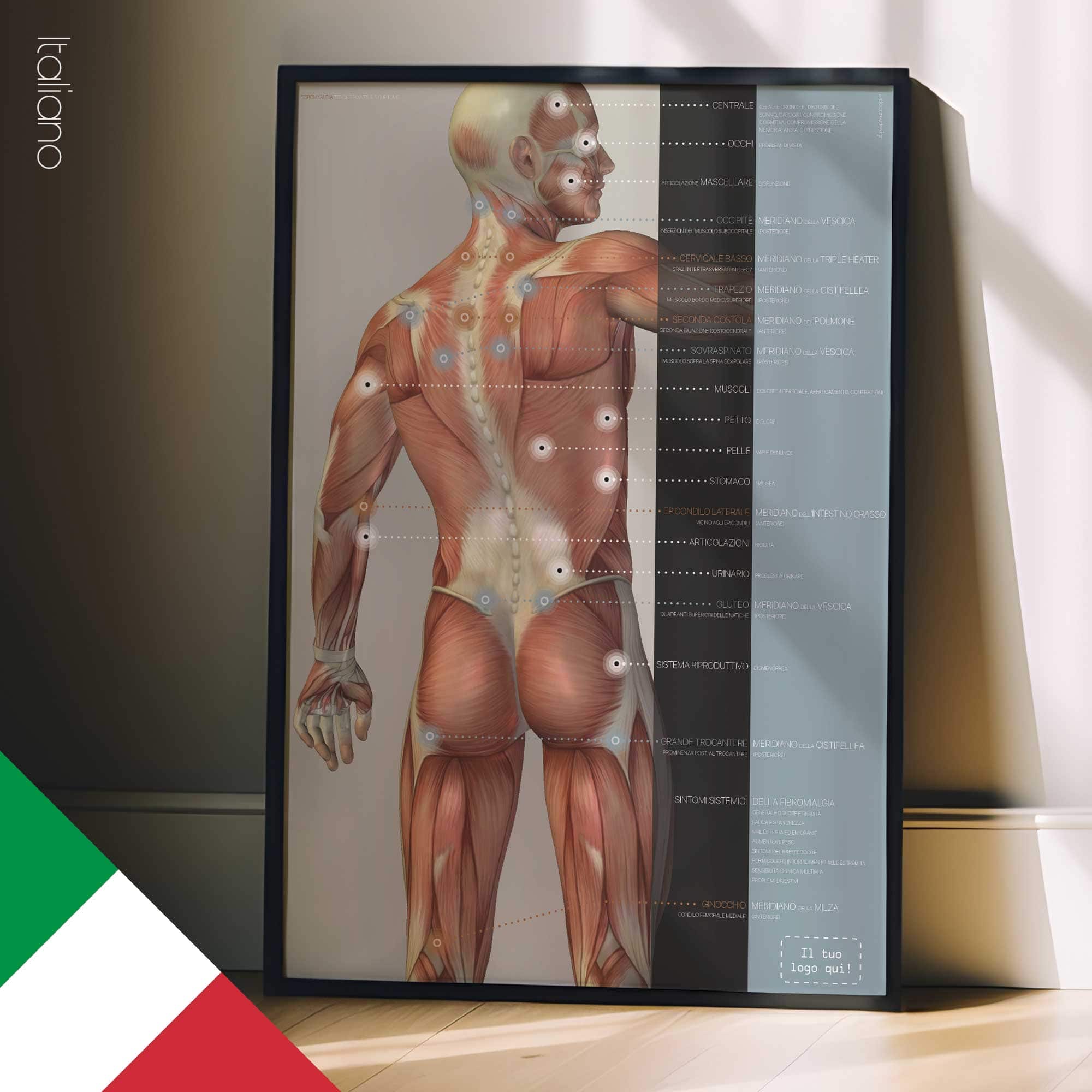 Fibromialgia; Punti teneri e sintomi