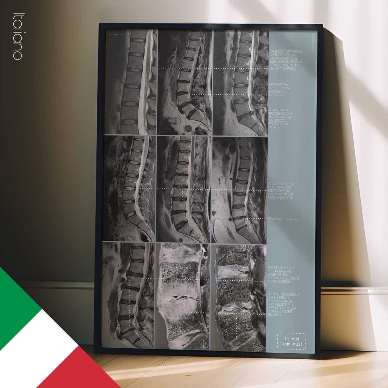 Patologia Lombare