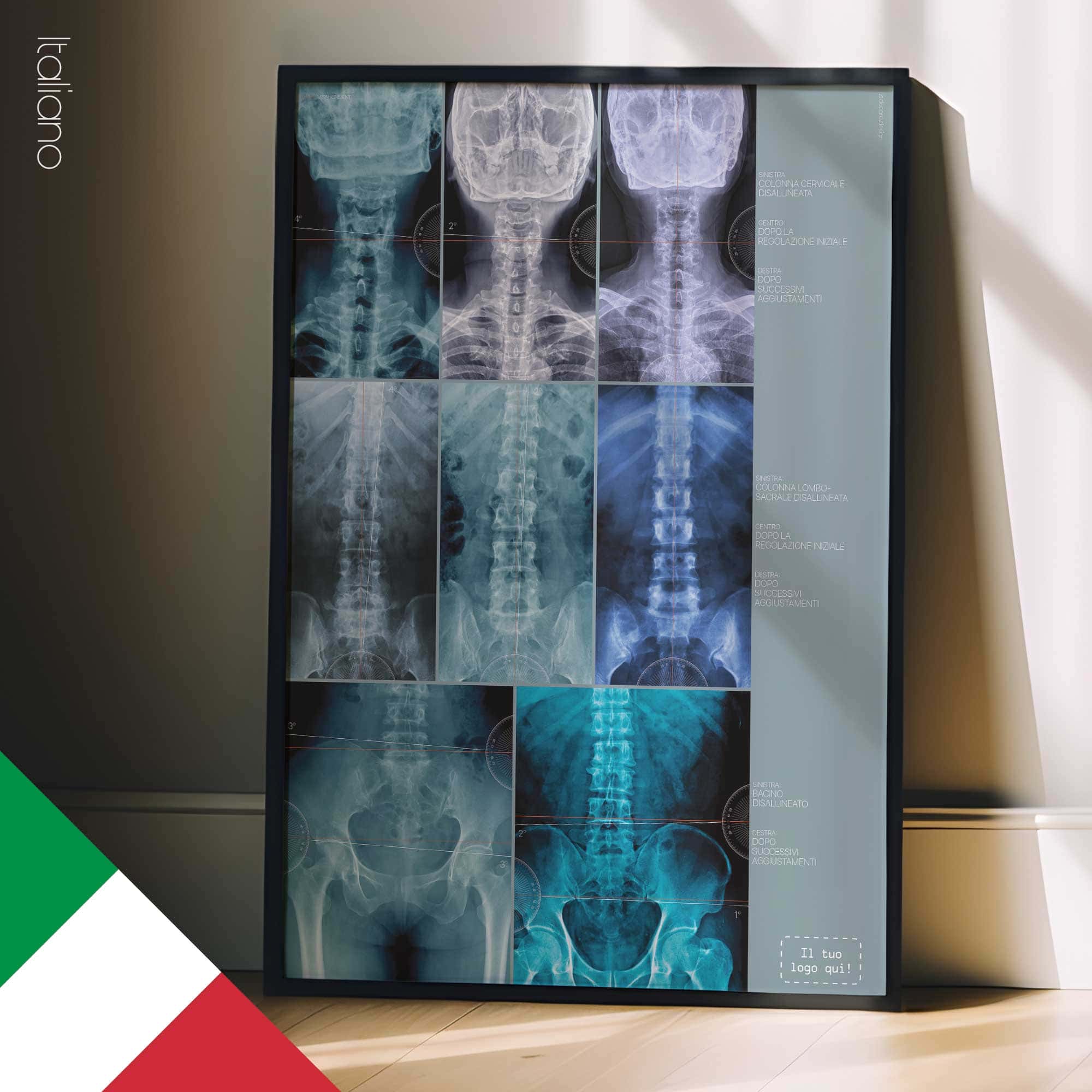 Disallineamento della Colonna Vertebrale