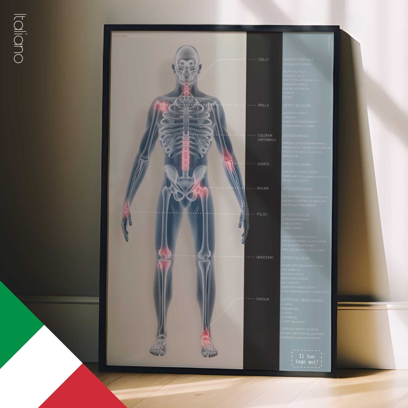 Osteoartrite