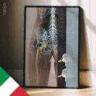 Sciatica e Stenosi