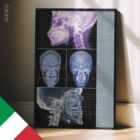 Disturbo Articolazione Temporo-Mandibolare