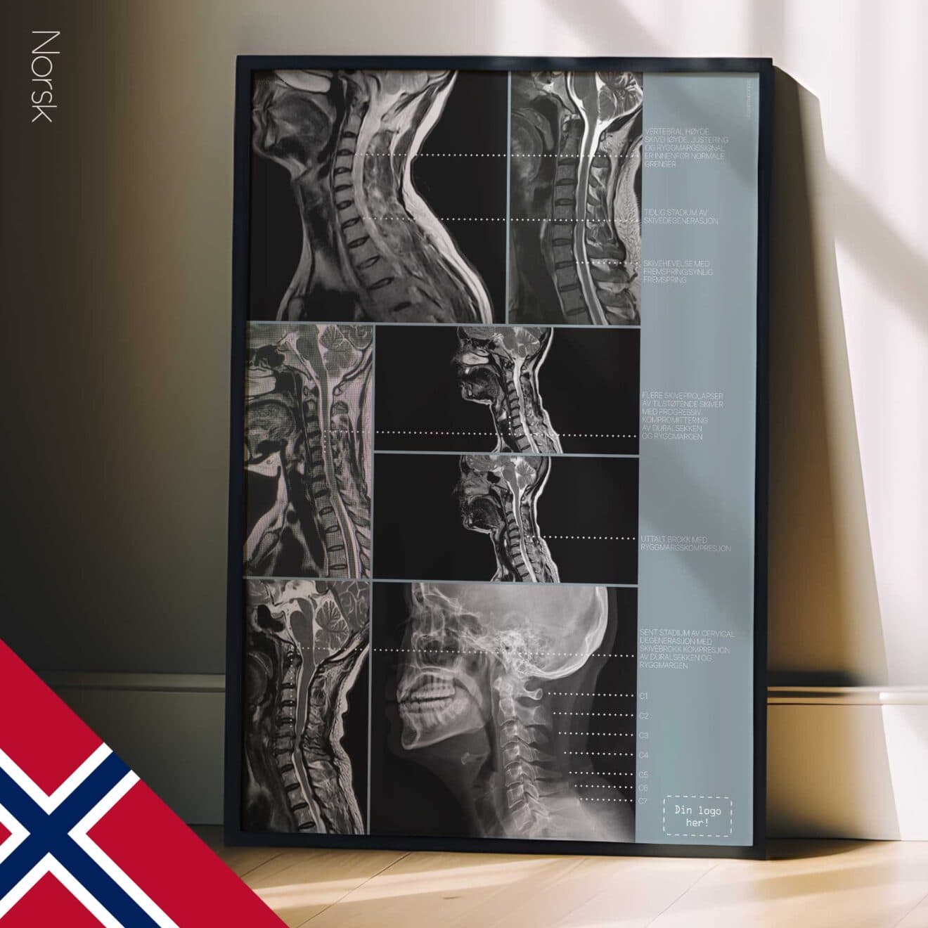 Kunstwerk zur Zervikalpathologie von educare.design