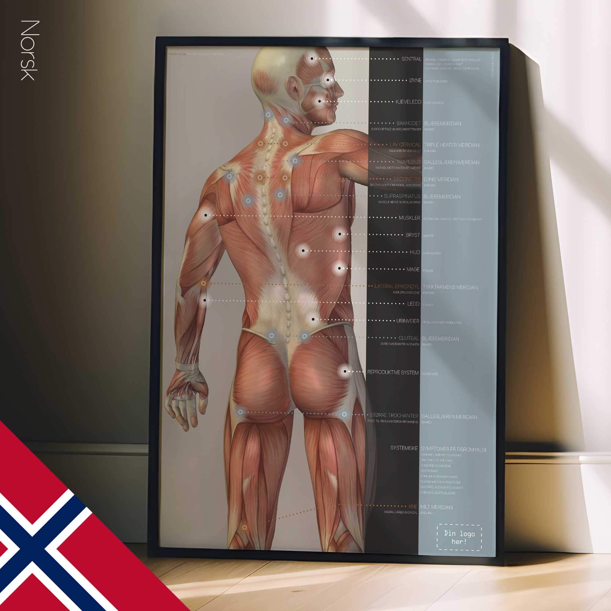 Fibromyalgia; Tender Points & Symptoms. Anatomy and physiology artwork from educare.design