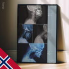 Postura della testa in avanti