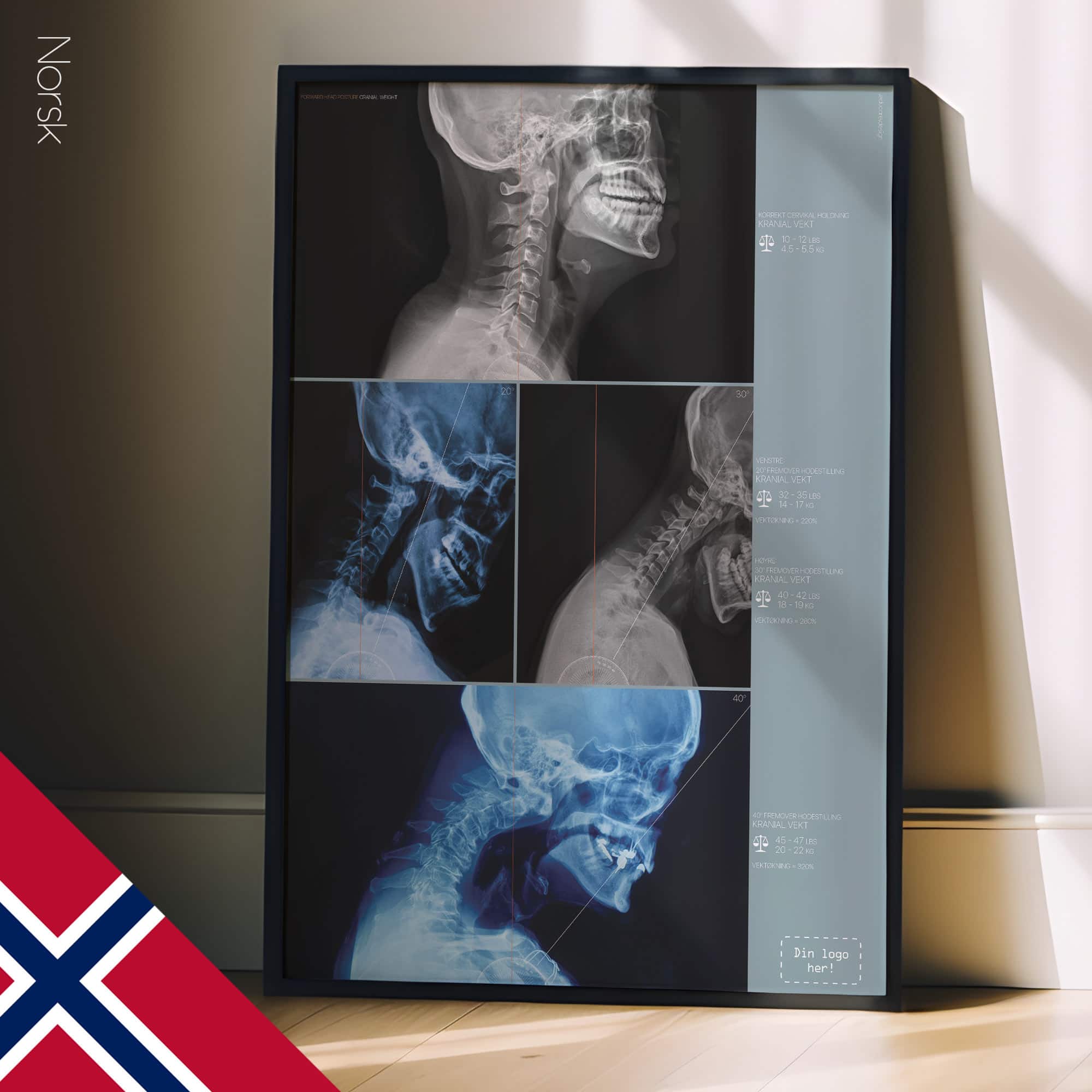 Postura della testa in avanti