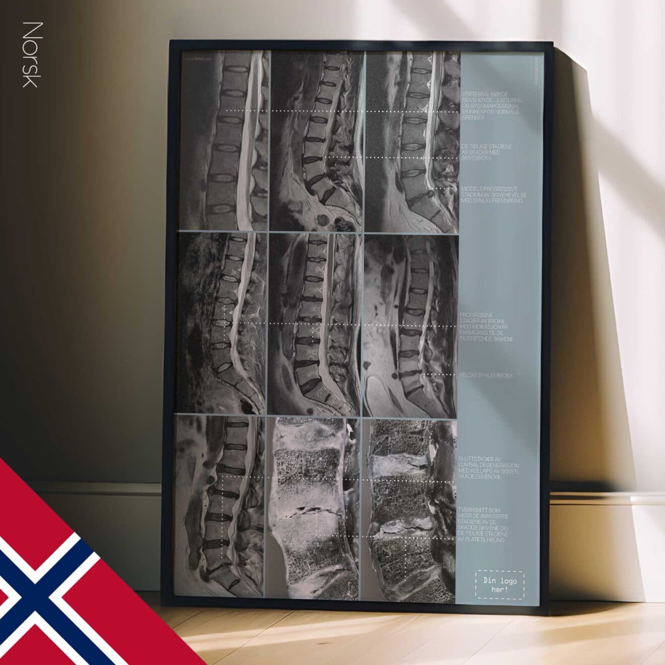 Opere d'arte sulla patologia lombare da educare.design