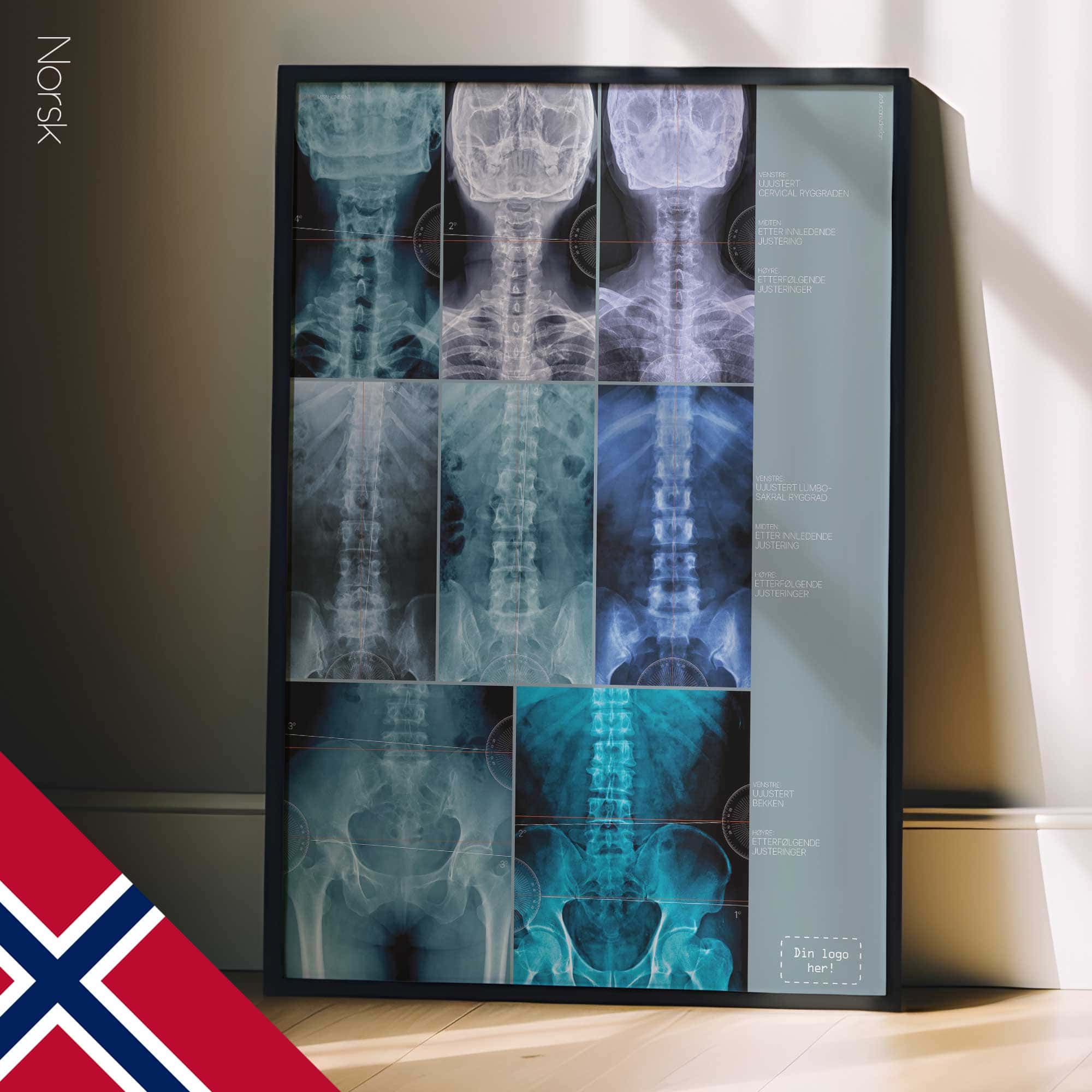 Fehlausrichtung, Anatomie und Physiologie - Kunstwerke von educare.design